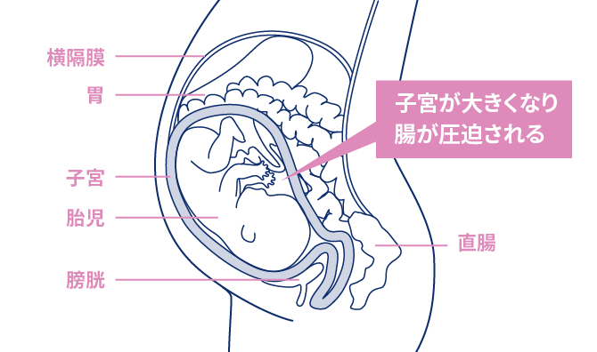 医師監修 妊婦の多くがなる便秘 今日からできる5つの対処法 エレビットの葉酸サプリは根拠がある葉酸800mg バイエル薬品