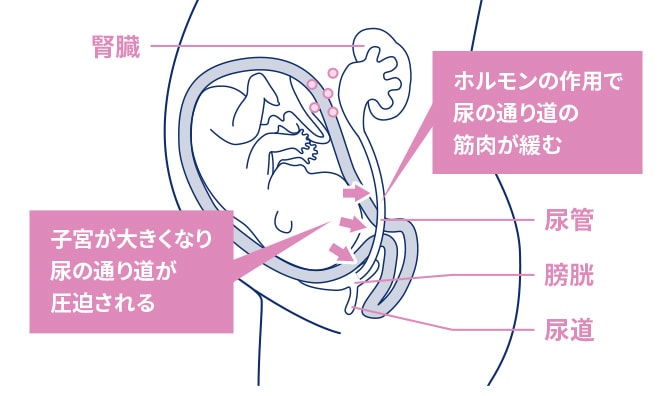 医師監修 妊婦さんに多い膀胱炎 妊娠に影響はある エレビットの葉酸サプリは根拠がある葉酸800mg バイエル薬品
